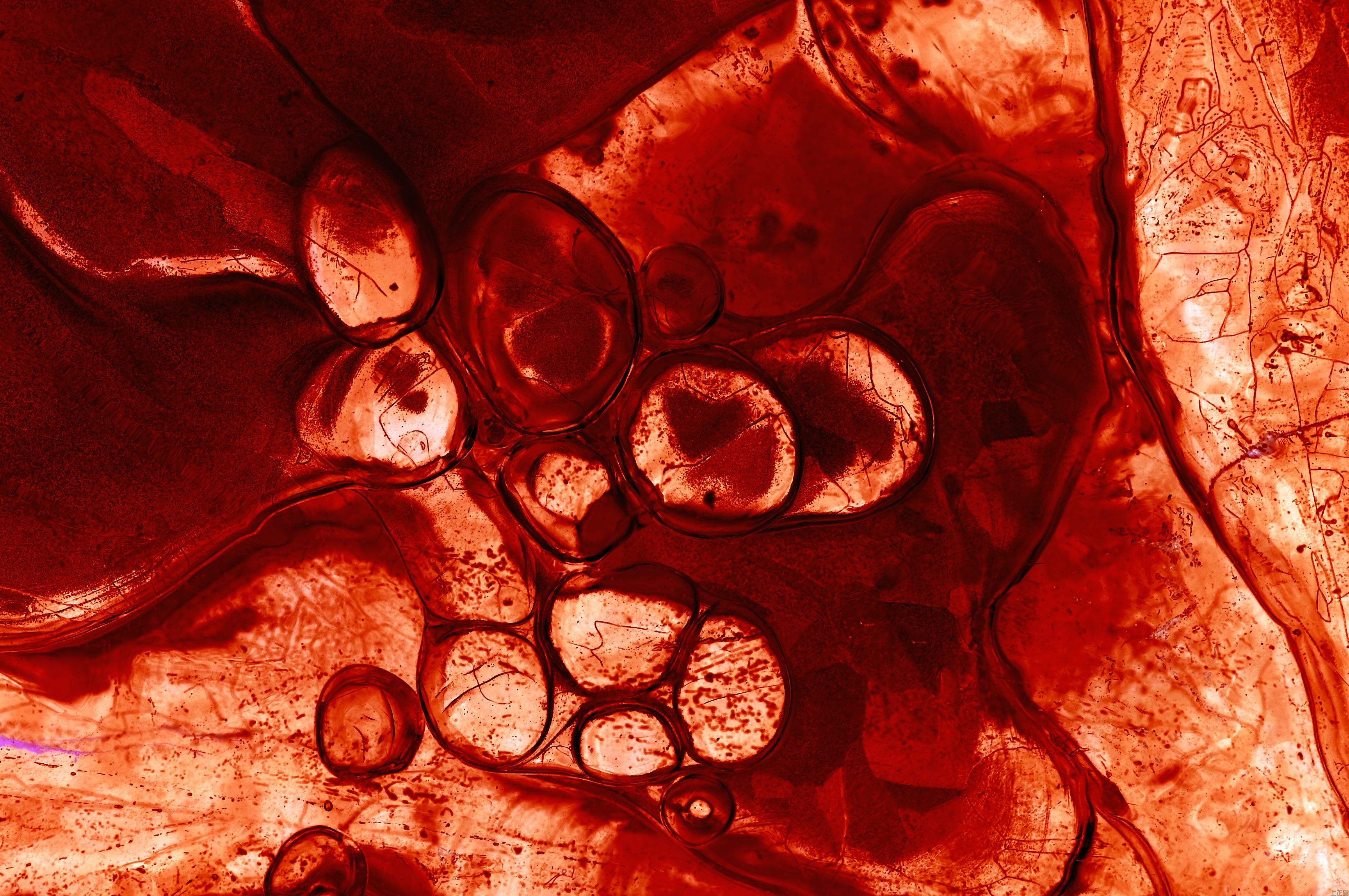 中醫養生!先養肝還是先調脾胃